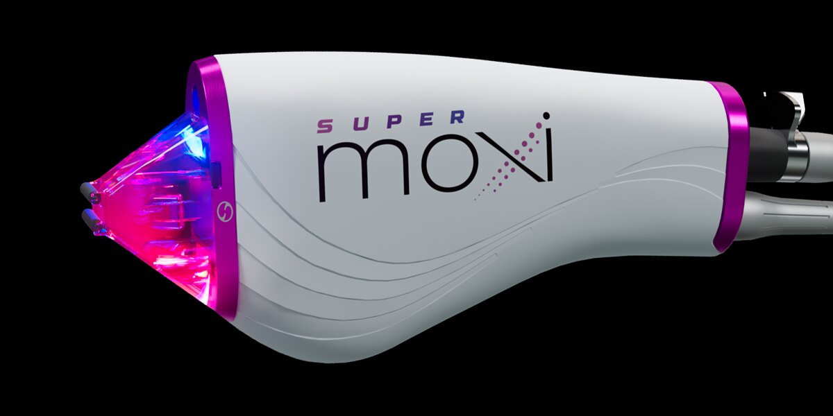 Super MOXI